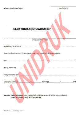 Wynik badania EKG - druk